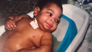 A baby in a small tub. There is a piece of gauze taped to his chest.